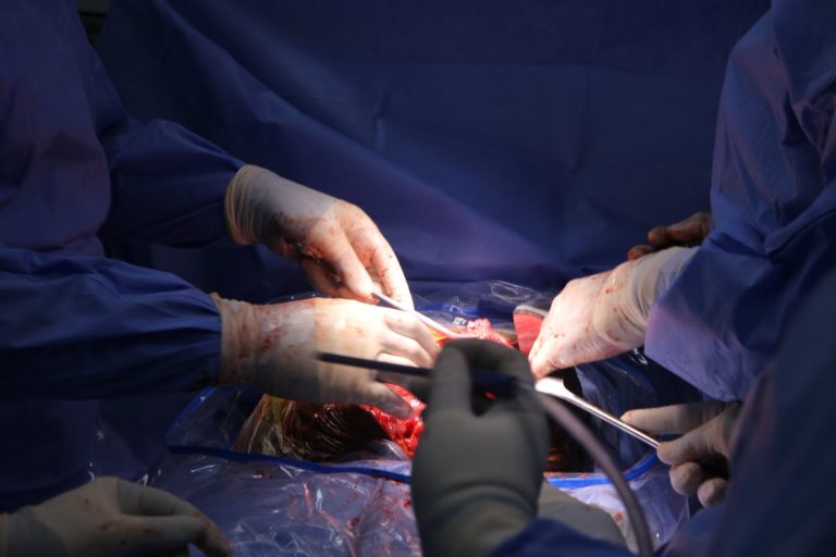 Ghana: Dying cancer patient saved by historic surgery